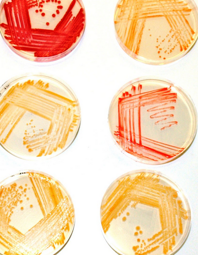 bacteria color